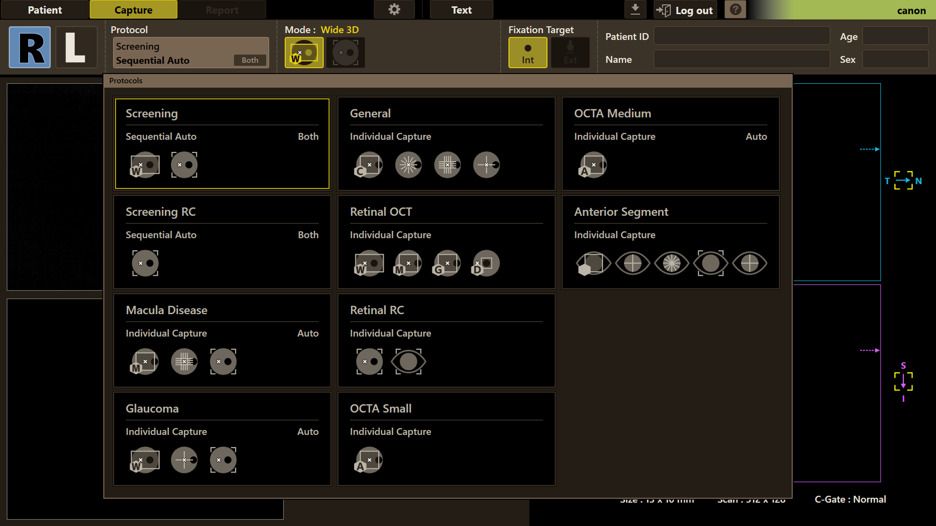Canon Full Auto Combo OCT Retinal Camera Xephilio OCT-R1 Comprehensive Overview Report