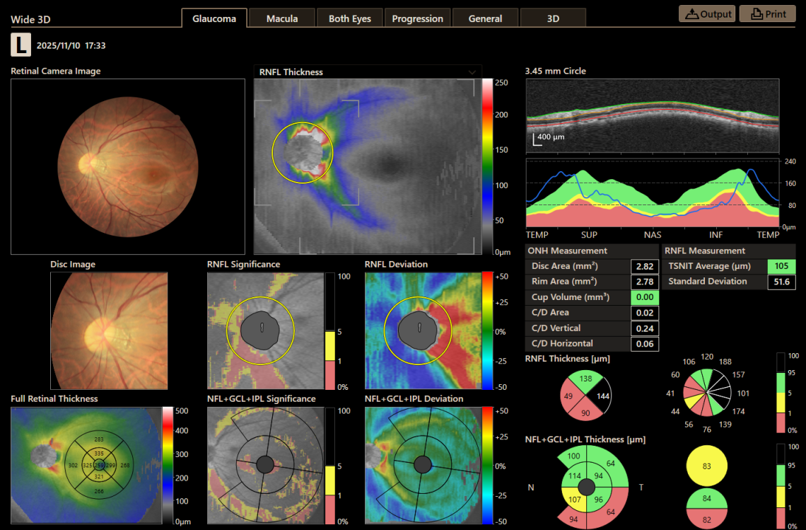 Canon Full Auto Combo OCT Retinal Camera Xephilio OCT-R1 Comprehensive Overview Report