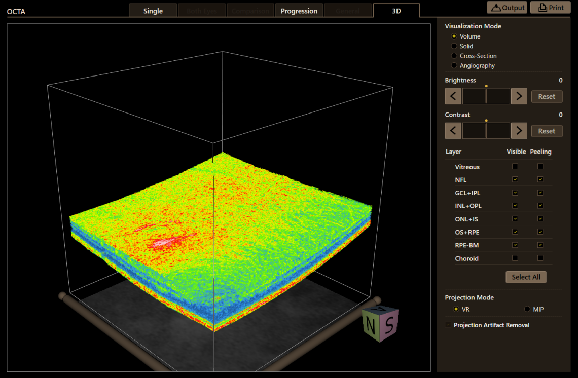 Canon Full Auto Combo OCT Retinal Camera Xephilio OCT-R1 Comprehensive Overview Report
