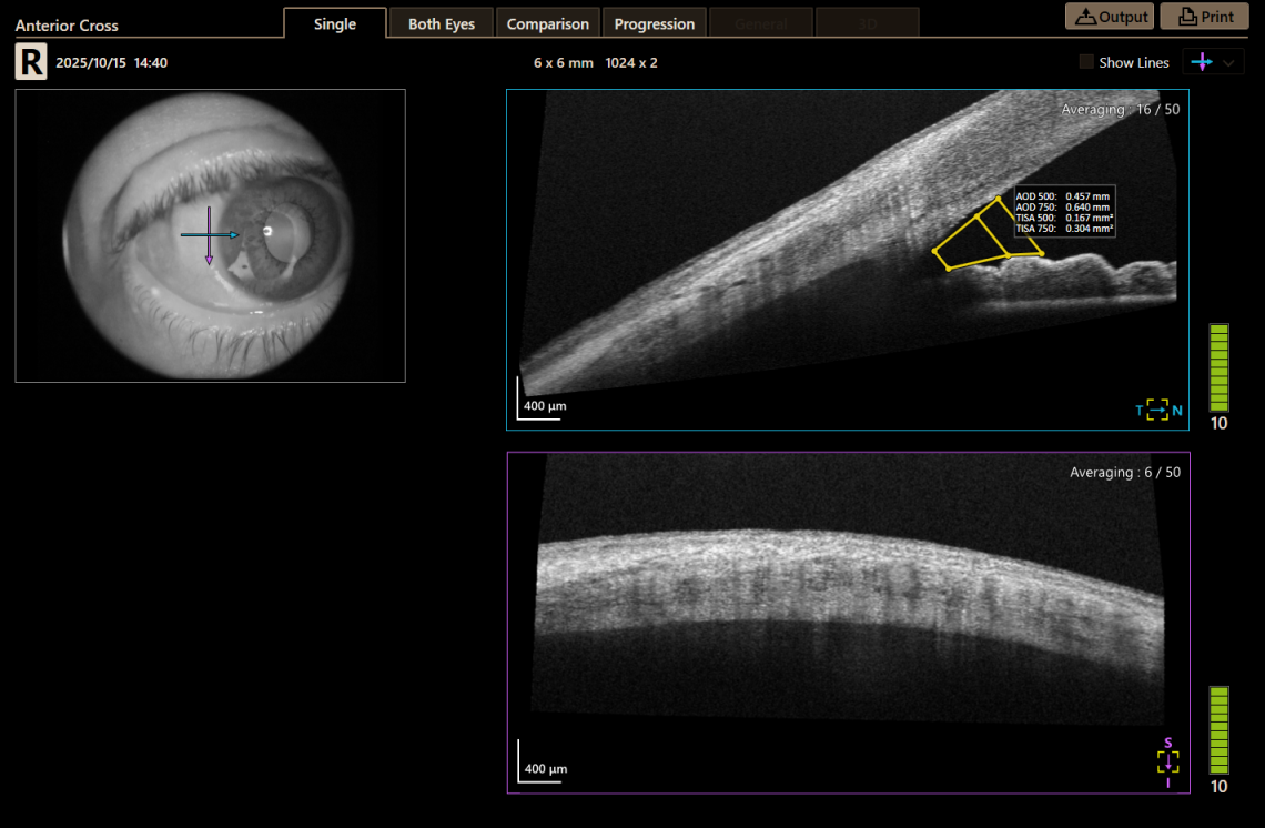 Canon Full Auto Combo OCT Retinal Camera Xephilio OCT-R1 Comprehensive Overview Report