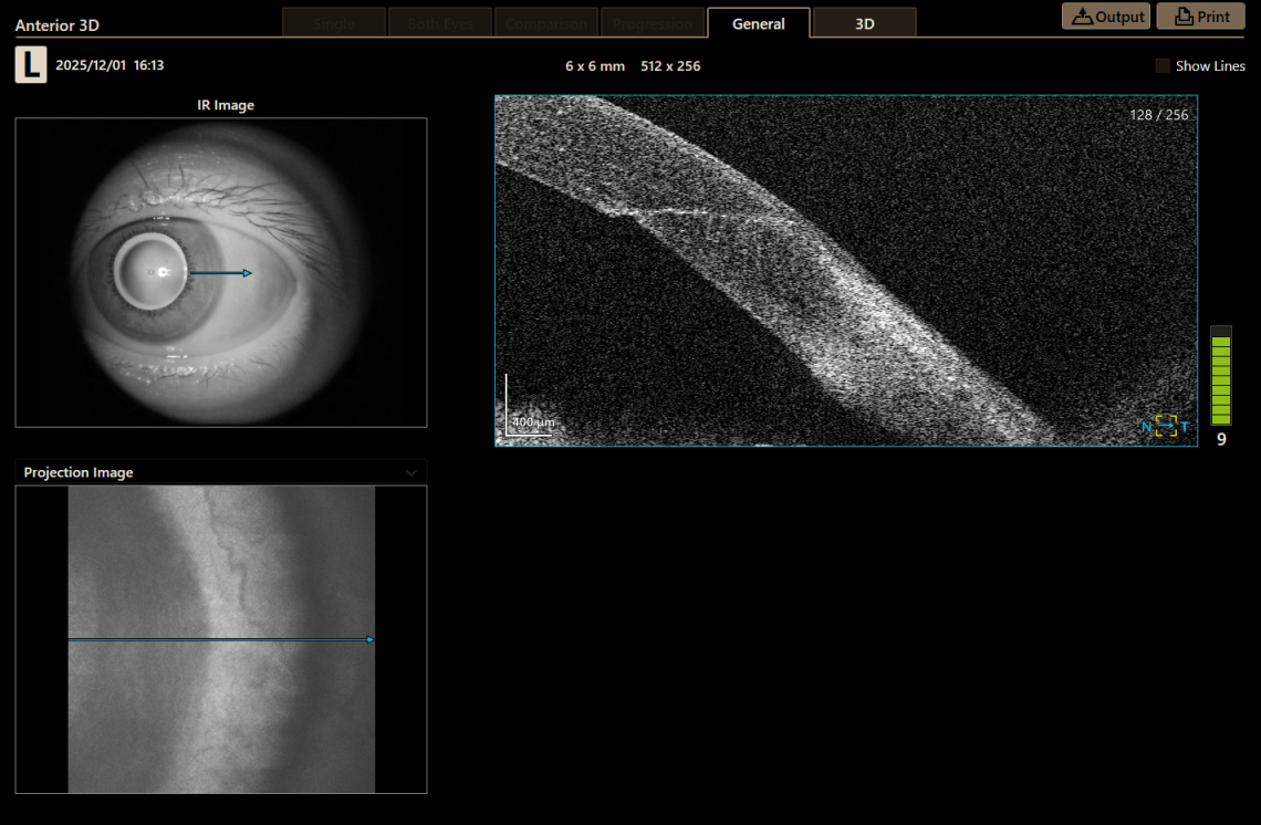 Canon Full Auto Combo OCT Retinal Camera Xephilio OCT-R1 Comprehensive Overview Report