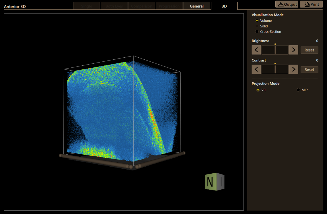 Canon Full Auto Combo OCT Retinal Camera Xephilio OCT-R1 Comprehensive Overview Report