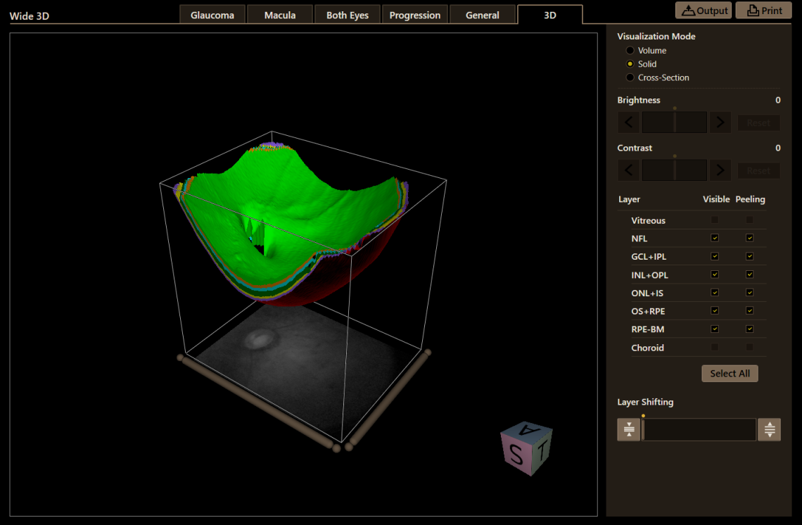 Canon Full Auto Combo OCT Retinal Camera Xephilio OCT-R1 Comprehensive Overview Report