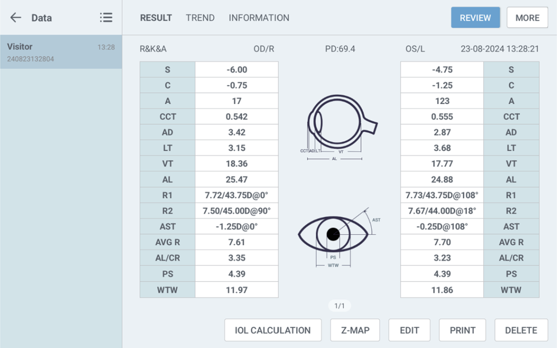 auto refractor biometer combination Myopia Pro 800 result table