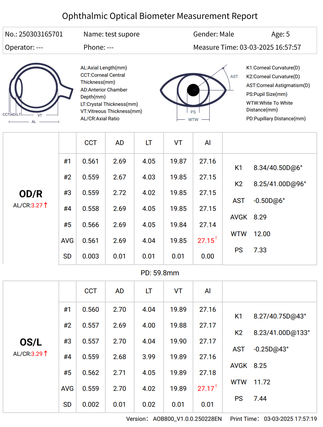 auto refractor biometer combination Myopia Pro 800 sample report