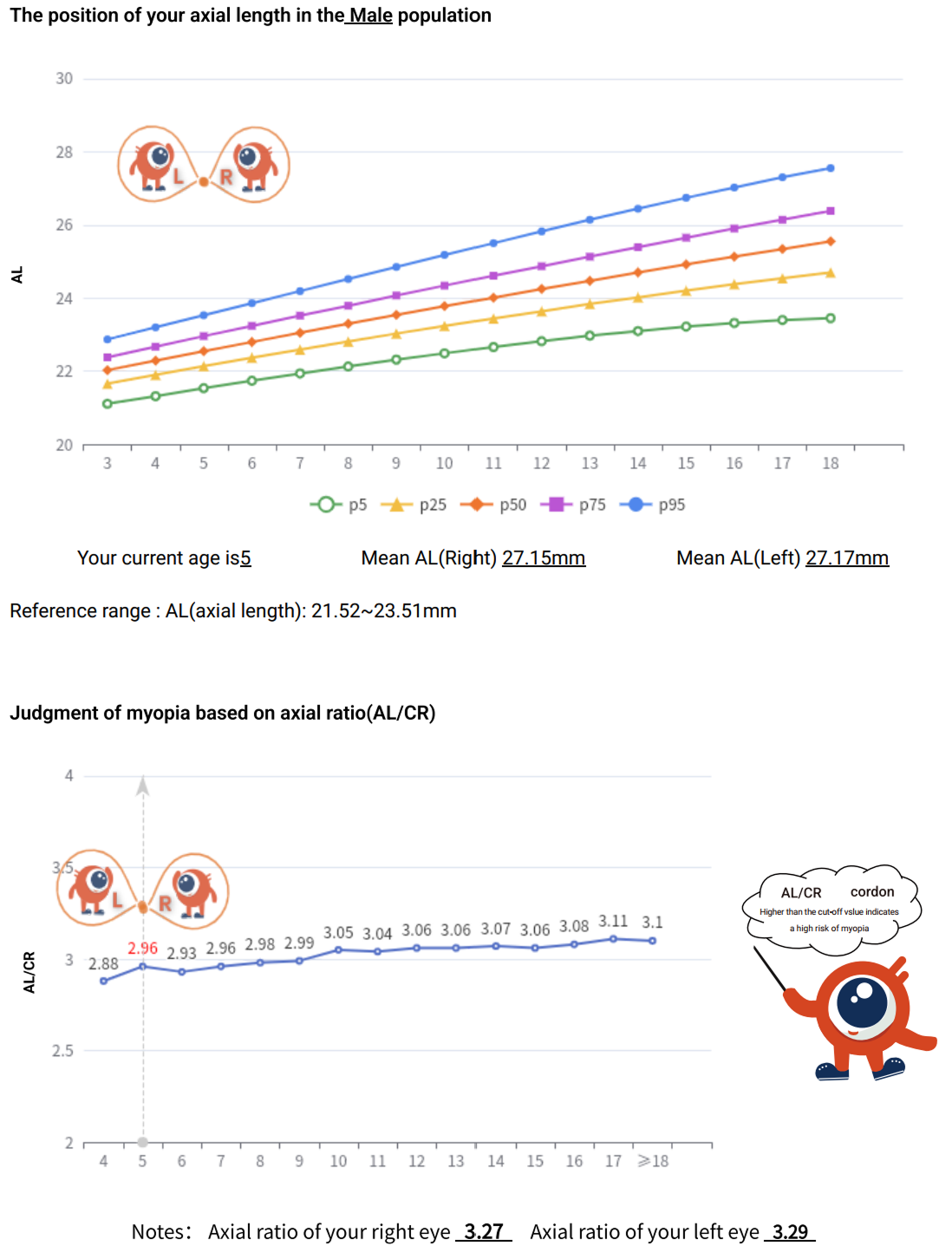 auto refractor biometer combination Myopia Pro 800 sample report