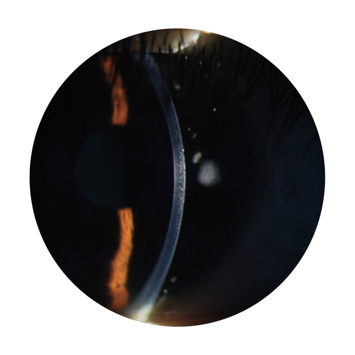 Main MediTech Slit Lamp SL-2S